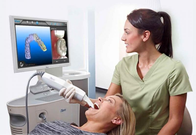 Digital Dental Scanning